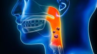 Dispar mortalidad por cáncer oral y orofaríngeo en Latinoamérica
