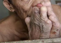 La OMS declara a Chile primer país de América libre de lepra