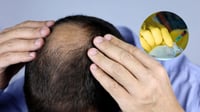 ¿El fin de la alopecia? El histórico avance en laboratorio que cambiará la medicina