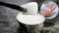 Quemadura con hielo seco: qué hacer ante una lesión y cómo evitar complicaciones