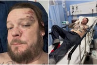 Corey Harrison de “El precio de la historia” solicita ayuda tras accidente