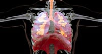 Qué es la sarcoidosis, la enfermedad rara que puede afectar pulmones, piel y ojos