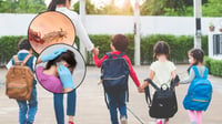 ¿Cómo evitar contagio de piojos en niños en la escuela?