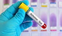 Análisis de sangre podría anticipar el riesgo de demencia hasta 25 años antes