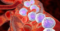 Una prueba genética puede predecir el riesgo de recaída de leucemia