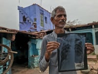 Qué es la silicosis, la enfermedad que daña los pulmones de los trabajadores de la construcción