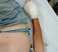 Víbora de cascabel muerde a adulto mayor en San Buenaventura