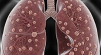 Inflamación y plasticidad celular explicarían la resistencia del cáncer de pulmón