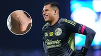 El portero del América, Malagón, comparte imagen de su cicatriz y envía mensaje de fe