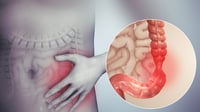 Síndrome del intestino irritable: qué sucede en el organismo durante una crisis y cuánto puede durar