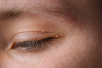 Señales en tus ojos que revelan niveles de colesterol alto