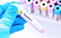 Ignorar la hepatitis C podría llevar a cirrosis o cáncer