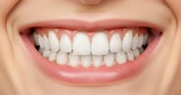 Bebidas y alimentos cotidianos que aceleran el desgaste del esmalte dental