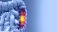 Señales de cáncer colorrectal que aparecen tarde y ponen en riesgo tu vida