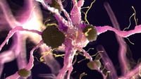 Análisis de sangre predice Alzheimer años antes de los síntomas y cambios cerebrales