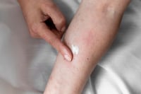 Tu cuerpo te advierte: estos síntomas pueden revelar falla renal temprana