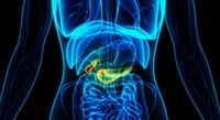 Señales silenciosas de cáncer de páncreas que no debes ignorar