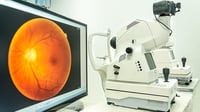 Las fotos oculares podrían ofrecer una alerta temprana de problemas crónicos de salud