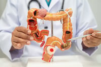 Señales silenciosas de tumores digestivos que no debes ignorar