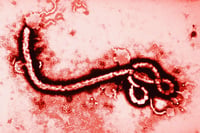 Ébola: por qué es uno de los virus más letales del mundo