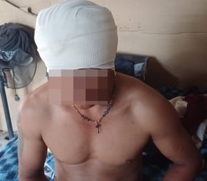     Testigos señalaron que el afectado fue atacado sin piedad.  La madrugada de este sábado, una fuerte riña entre rancheros en el ejido Acámbaro del municipio