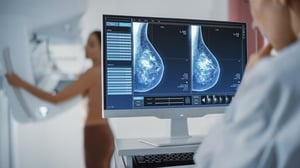 Una nueva inteligencia artificial (IA) ha demostrado ser capaz de identificar con mayor precisión a las mujeres con alto riesgo de desarrollar cáncer de mama