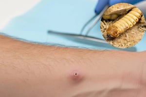 México confirmó cinco casos nuevos de miasis por gusano barrenador en una semana, mientras el brote avanza en el sur del país y afecta también al ganado.