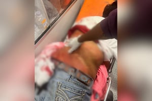 El lesionado fue llevado a la Clínica 7 del IMSS de Monclova.  Lo que debía ser una noche de convivencia y devoción en honor a la Virgen María terminó empañado