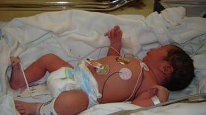 La bronquiolitis es una de las causas más frecuentes de hospitalización en lactantes y niños pequeños, especialmente durante la temporada de frío.  Cada año,