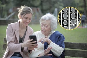 La investigación en busca de tratamientos efectivos contra el Alzheimer ha dado un paso importante. Científicos del Instituto Max Planck