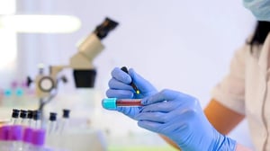 En México, el cáncer se mantiene como una de las principales causas de mortalidad. Tan solo en 2024, los tumores malignos ocasionaron 95,108 defunciones (cifra