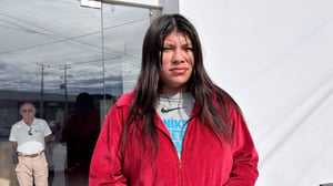 Pequeña Margarita permanece grave en terapia intensiva y será sometida a injertos de piel especializados  La pequeña Margarita, de apenas un año y dos meses