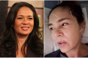 Yolanda Andrade compartió imágenes del deterioro físico que ha sufrido por la Esclerosis Lateral Amiotrófica, agradeciendo el apoyo del público durante