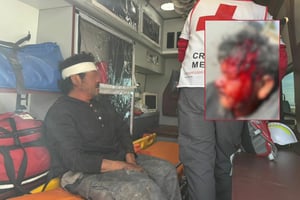 El hecho movilizó a la Policía Municipal y a socorristas.  La tarde de este jueves, un hombre resultó con una severa lesión en la cabeza y abundante