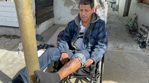 José Luis Valdez Almaguer solicita apoyo tras sufrir fractura expuesta en accidente automovilístico; autoridades lo responsabilizaron y el responsable incumple