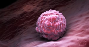 La Organización Mundial de la Salud (OMS) y el Centro Internacional de Investigaciones sobre el Cáncer (CIIC) dieron a conocer que cerca