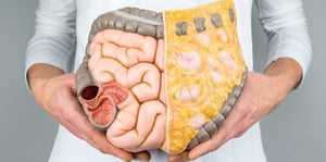 La grasa visceral, que se acumula profundamente en el abdomen alrededor de órganos vitales, se ha convertido en un importante riesgo oculto para la salud.
