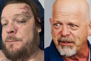 Rick Harrison aclaró que ya pagó los gastos médicos de su hijo Corey tras su accidente en motoneta en Tulum, antes de la campaña de donaciones.  El hijo