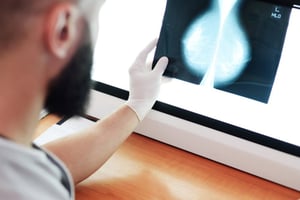 Adoptar un estilo de vida saludable y realizar chequeos médicos de forma periódica puede ser determinante en la prevención del cáncer de mama. Aunque factores