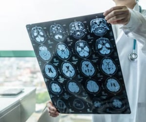 Un brote de meningitis en Inglaterra dejó dos muertos y 20 casos, activando alertas sanitarias en universidades y medidas urgentes para contener contagios.