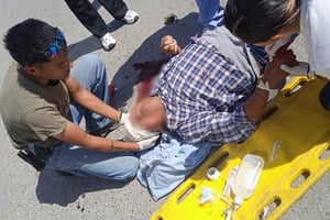 De acuerdo al dictamen médico el hombre presentaba un traumatismo craneoencefálico.   El ciclista que había resultado gravemente lesionado