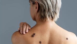 La piel es el órgano más grande del cuerpo y, con frecuencia, uno de los primeros en reflejar alteraciones internas o daño celular causado por la exposición