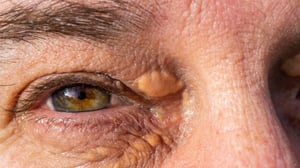 Se dice que los ojos son la ventana del alma, pero también pueden reflejar el estado de tu sistema circulatorio. Observar tu mirada cada mañana puede ayudarte