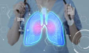 Muchas de las alteraciones que aparecen en las pruebas para detectar cáncer de pulmón resultan ser benignas e inofensivas, aunque unas pocas sí representan