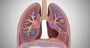 El cáncer de pulmón de células pequeñas combinado (cSCLC) es un tipo poco común y complejo que reúne distintos tipos de células cancerosas dentro de un mismo