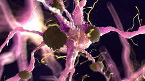 Un estudio reciente sugiere que un análisis de sangre podría anticipar la evolución del Alzheimer en el cerebro varios años antes de que aparezcan los primeros