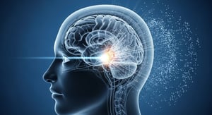 La hipersomnia idiopática y la narcolepsia son dos trastornos neurológicos diferentes que provocan somnolencia excesiva durante el día y pueden interferir