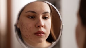 Despertar con el rostro hinchado, notar acumulación de grasa en el abdomen o sentir un cansancio que no desaparece ni después de descansar puede parecer algo