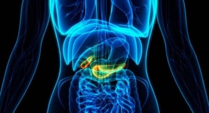 El cáncer de páncreas es una de las enfermedades más difíciles de detectar, ya que en sus primeras etapas suele avanzar sin síntomas evidentes. Con frecuencia,