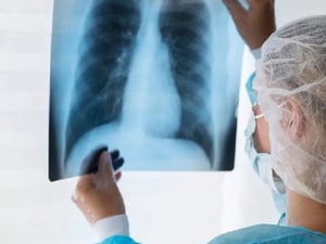 La tuberculosis continúa siendo un problema de salud vigente. Aunque hoy existen tratamientos y medidas de prevención, especialistas advierten